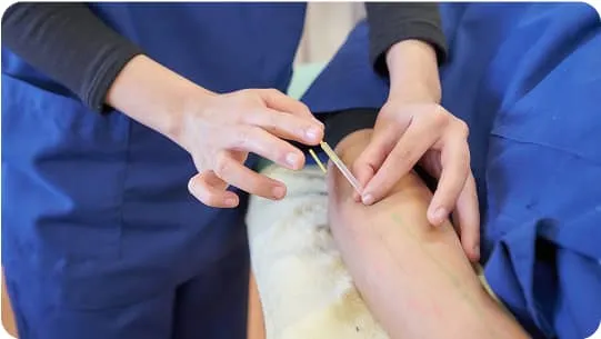 腕に鍼を打っている様子