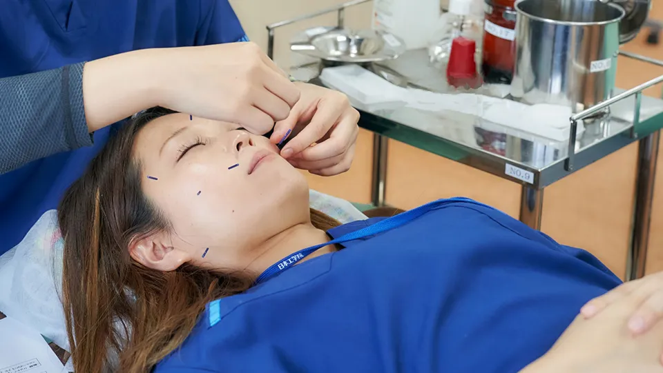 学生が顔に鍼を打たれている様子